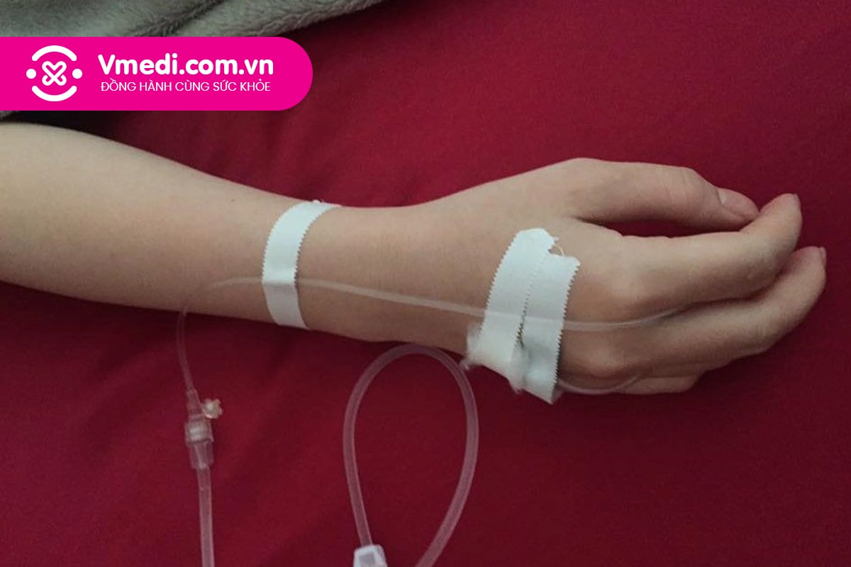 quy-trinh-va-ky-thuat-truyen-dich