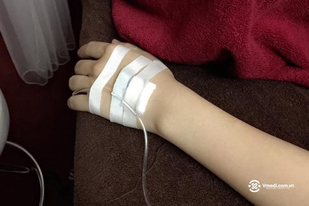 anh-chup-tay-truyen-nuoc