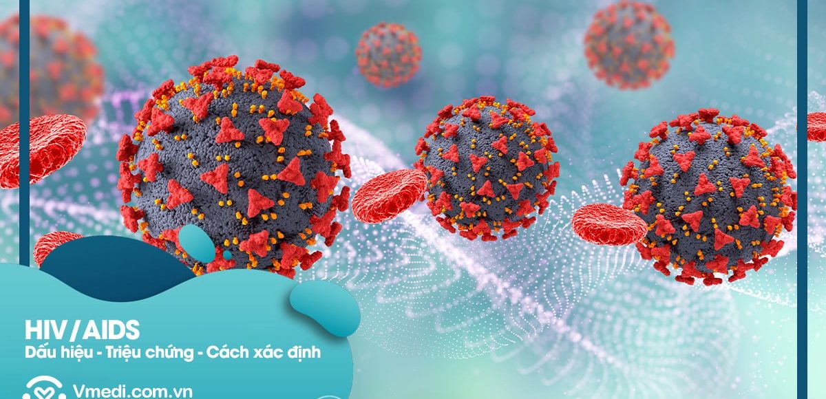 dau-hieu-trieu-chung-nhiem-HIV