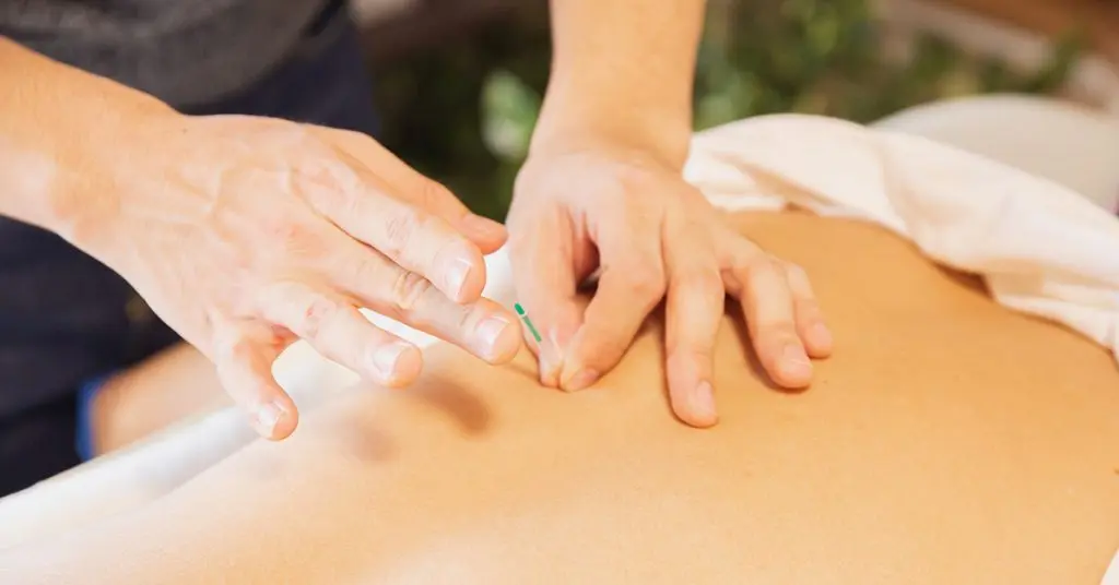Châm cứu tại nhà hỗ trợ giảm đau hiệu quả Bác sĩ châm cứu điều trị đau thần kinh tọa tại nhà cho bệnh nhân