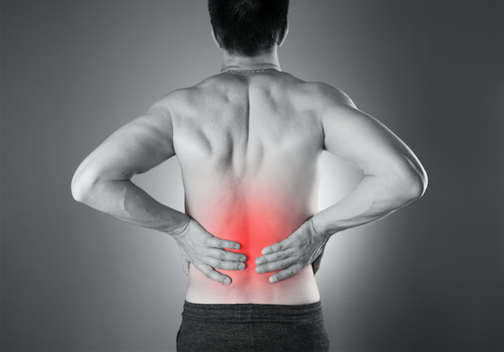 Triệu chứng đau thần kinh tọa điển hình Hình ảnh minh họa đau thần kinh tọa lan xuống chân, bao gồm các vùng bị ảnh hưởng